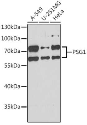 Western Blot: PSG1 AntibodyBSA Free [NBP2-93944]